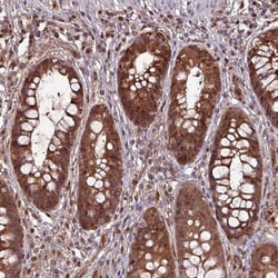 LMP7/PSMB8 Antibody, Novus Biologicals 0.1mL; Unlabeled:Antibodies, Polyclonal