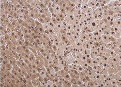 LMP7/PSMB8 Antibody, Novus Biologicals 0.1mL; Unlabeled:Antibodies