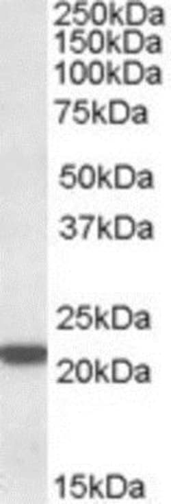 LMP7/PSMB8 Antibody, Novus Biologicals 0.1mg; Unlabeled:Anticuerpos