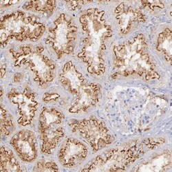 Kininogen Antibody, Novus Biologicals 25 &mu;L; Unlabeled:Antibodies, Polyclonal