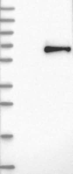 Kininogen Antibody, Novus Biologicals 25 &mu;L; Unlabeled:Antibodies, Polyclonal