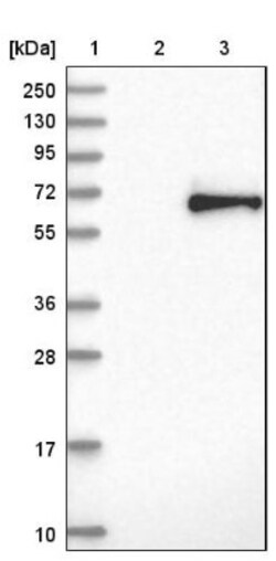 Kininogen Antibody, Novus Biologicals 25 &mu;L; Unlabeled:Antibodies, Polyclonal