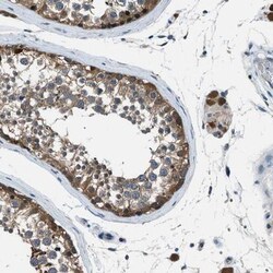 LMW-PTP/ACP1 Antibody, Novus Biologicals:Antibodies:Primary Antibodies