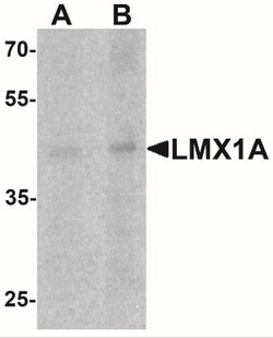 LMX1A Antibody - BSA Free, Novus Biologicals 0.025 mg, Unlabeled:Antibodies,