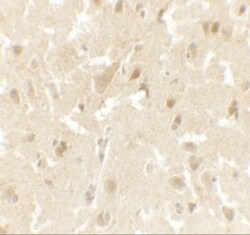 LMX1b Antibody - BSA Free, Novus Biologicals 0.025 mg, Unlabeled:Antibodies,