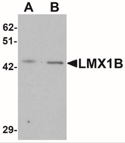 LMX1b Antibody - BSA Free, Novus Biologicals 0.025 mg, Unlabeled:Antibodies,