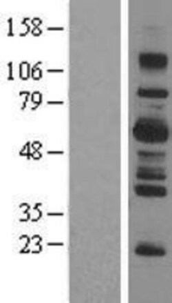 Novus Biologicals&trade;&nbsp;LNK/SH2B3 Overexpression Lysate