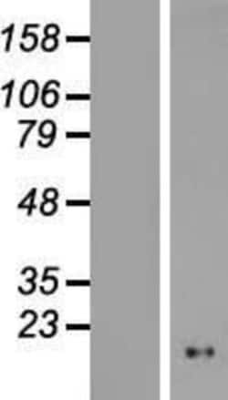 Novus Biologicals&trade;&nbsp;NOL4L-DT Overexpression Lysate