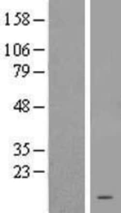 Novus Biologicals&trade;&nbsp;TRHDE-AS1 Overexpression Lysate