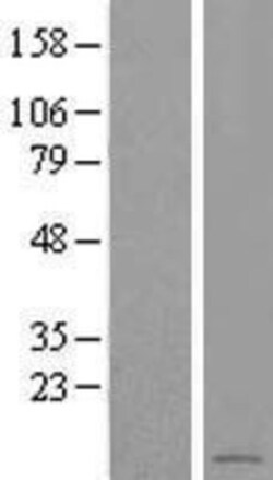 Novus Biologicals&trade;&nbsp;LOC284912 Overexpression Lysate