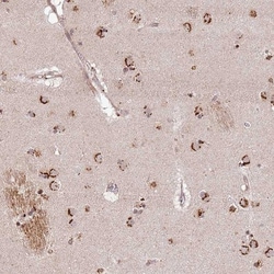 LOC388813 Antibody, Novus Biologicals 0.1mL; Unlabeled:Antibodies, Polyclonal