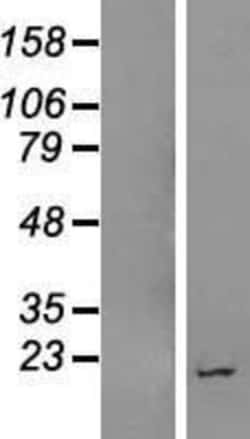 Novus Biologicals™ LOC400657 Overexpression Lysate