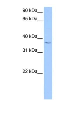 NLRP3/NALP3 Antibody (Nalpy3-b) - BSA Free, Novus Biologicals:Antibodies:Primary