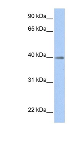 MGAT4EP Antibody, Novus Biologicals:Antibodies:Primary Antibodies