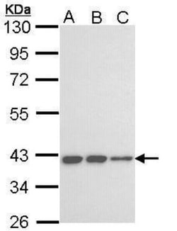 KIR3DL2/CD158k Antibody, Novus Biologicals 0.1 mL | Buy Online | Novus Biologicals | Fisher Scientific