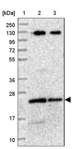 LOH12CR1 Antibody, Novus Biologicals 25 &mu;L, Unlabeled:Antibodies, Polyclonal