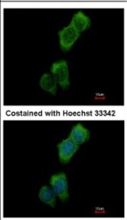 LOK Antibody, Novus Biologicals™