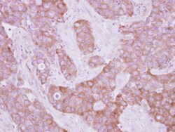 LOK Antibody, Novus Biologicals 0.1mL; Unlabeled:Antibodies, Polyclonal