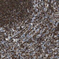 LOK Antibody, Novus Biologicals 0.1mL; Unlabeled:Antibodies, Polyclonal