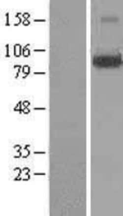 Novus Biologicals LONRF3 Overexpression Lysate 0.1 mg | Buy Online | Novus Biologicals&trade; | Fisher Scientific