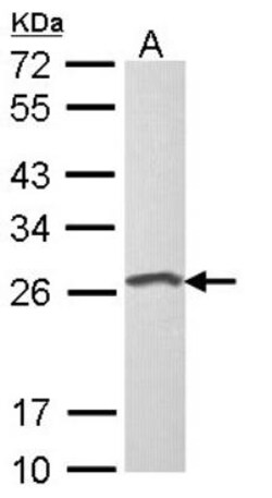 Loricrin Antibody, Novus Biologicals 0.1mL; Unlabeled:Antibodies, Polyclonal
