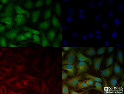 LOX Antibody, Novus Biologicals 0.1mL; Unlabeled:Antibodies, Polyclonal