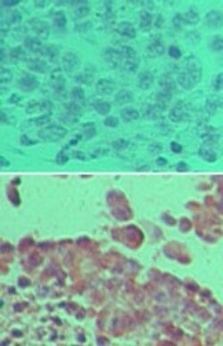 LOX Antibody, Novus Biologicals 0.1mL; Unlabeled:Antibodies, Polyclonal