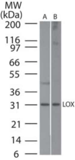 LOX Antibody, Novus Biologicals 0.1mL; Unlabeled:Antibodies, Polyclonal