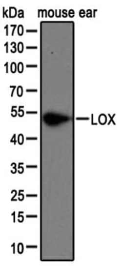 LOX Antibody, Novus Biologicals 0.1mL; Unlabeled:Antibodies, Polyclonal
