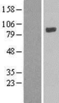 Novus Biologicals&trade;&nbsp;LOXL4 Overexpression Lysate