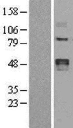 Novus Biologicals&trade;&nbsp;LOX Overexpression Lysate