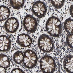 LPAR5/LPA5/GPR92 Antibody, Novus Biologicals 0.1 mL | Buy Online | Novus Biologicals | Fisher Scientific