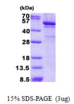 Novus Biologicals Recombinant Human LPCAT1 His Protein 0,02 mg | Buy Online | Novus Biologicals&trade; | Fisher Scientific