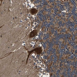 LPCAT1 Antibody, Novus Biologicals 25 &mu;L; Unlabeled:Antibodies, Polyclonal