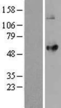 Novus Biologicals&trade;&nbsp;LPCAT2 Overexpression Lysate