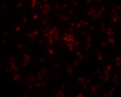 LPCAT2 Antibody, Novus Biologicals 25 &mu;L; Unlabeled:Antibodies, Polyclonal