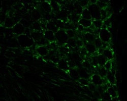 LPCAT2 Antibody, Novus Biologicals 25 &mu;L; Unlabeled:Antibodies, Polyclonal