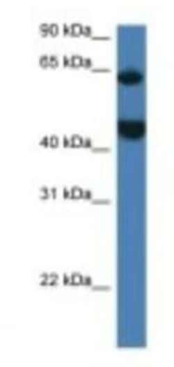 LPCAT2 Antibody, Novus Biologicals 100&mu;L; Unlabeled:Antibodies, Polyclonal