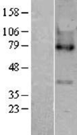 Novus Biologicals&trade;&nbsp;LPCAT3 Overexpression Lysate