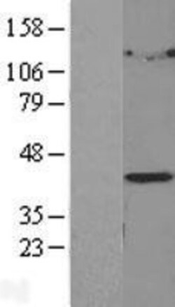 Novus Biologicals&trade;&nbsp;LPGAT1 Overexpression Lysate