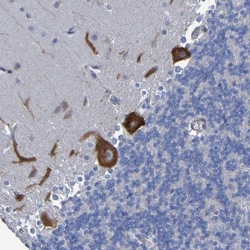 LPP Antibody, Novus Biologicals:Antibodies:Primary Antibodies