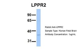LPPR2 Antibody, Novus Biologicals 0.05mg; Unlabeled:Antibodies, Polyclonal
