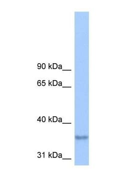 LPPR2 Antibody, Novus Biologicals 0.05mg; Unlabeled:Antibodies, Polyclonal