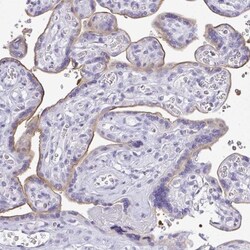 LPPR3 Antibody, Novus Biologicals 25 &mu;L, Unlabeled:Antibodies, Polyclonal