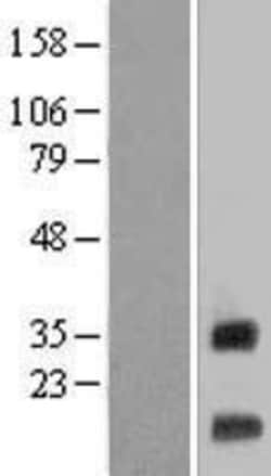 Novus Biologicals™ LR8 Overexpression Lysate