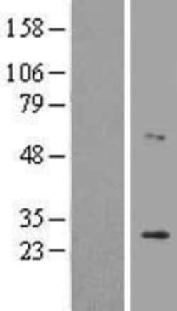 Novus Biologicals&trade;&nbsp;LRAT Overexpression Lysate