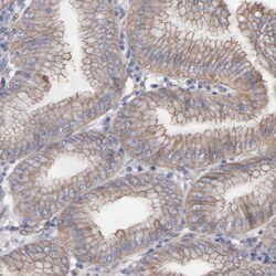LRCH2 Antibody, Novus Biologicals:Antibodies:Primary Antibodies