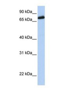 LRCH4 Antibody, Novus Biologicals 0.05mg; Unlabeled:Antibodies, Polyclonal