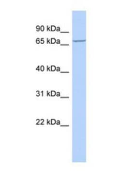 LRCH4 Antibody, Novus Biologicals 0.05mg; Unlabeled:Antibodies, Polyclonal