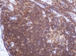 LRCH4 Antibody (OTI1F8), Novus Biologicals 0.1mL; Unlabeled:Antibodies,